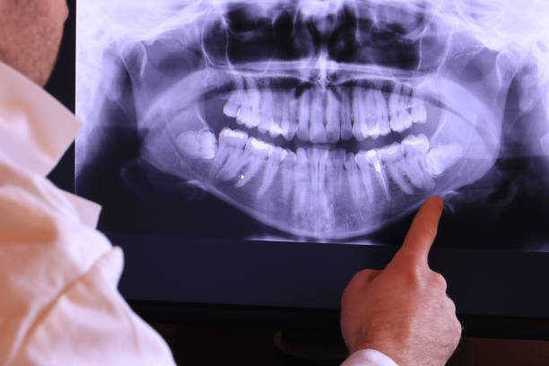 Best Pediatric Emergency Dentist in Ellijay, GA