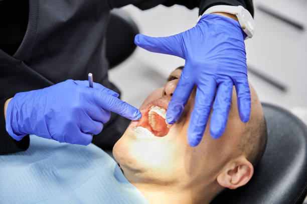 Best Emergency Dental Extractions in Ellijay, GA